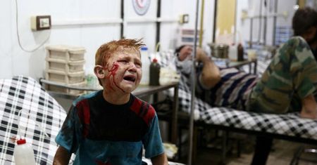 Medycyna podziemna w Syrii. Baszar al-Asad celowo niszczy szpitale, a lekarze przenoszą się do jaskiń i tuneli