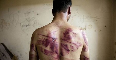 AI: Od 2011 roku w rządowych więzieniach w Syrii zginęło prawie 18 tys. osób