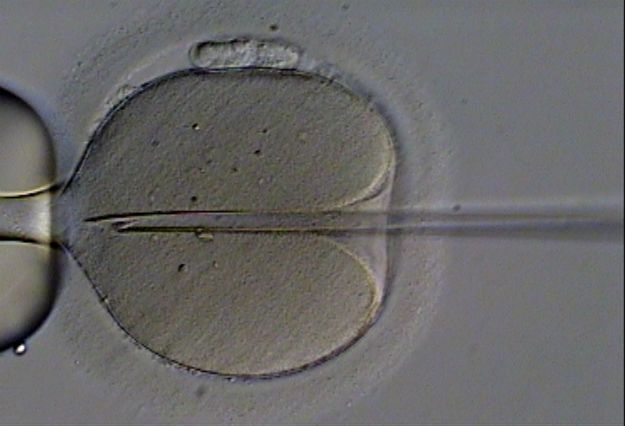 Śledztwo ws. błędu przy zapłodnieniu in vitro w klinice w Policach najprawdopodobniej zostanie umorzone