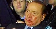 Berlusconi zaatakowany