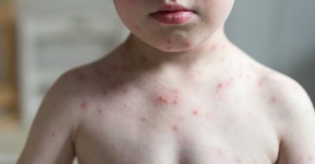 Tajemnicza przypadłość u dzieci. Lekarze nie wiedzą, czy jest związana z koronawirusem