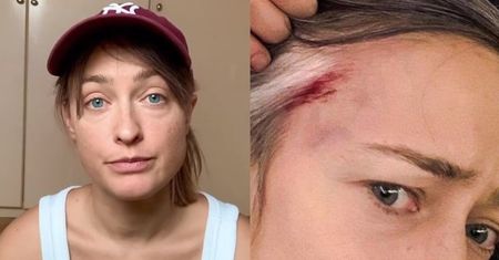 Matylda Damięcka oskarża policjanta o pobicie KRÓTKOFALÓWKĄ: "Mam to nagrane"