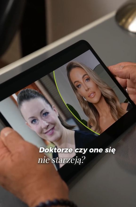 Specjalista przeanalizował przemianę twarzy Małgorzaty Rozenek
