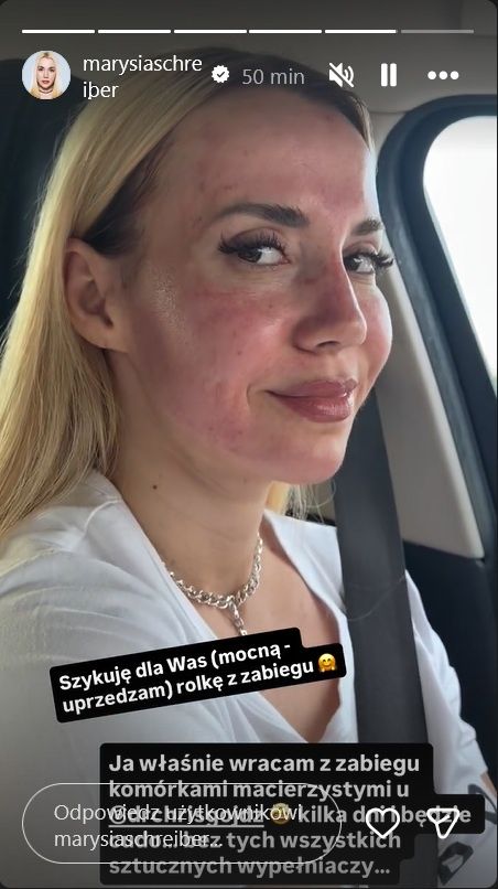 Marianna Schreiber pokazała się po zabiegu kosmetycznym