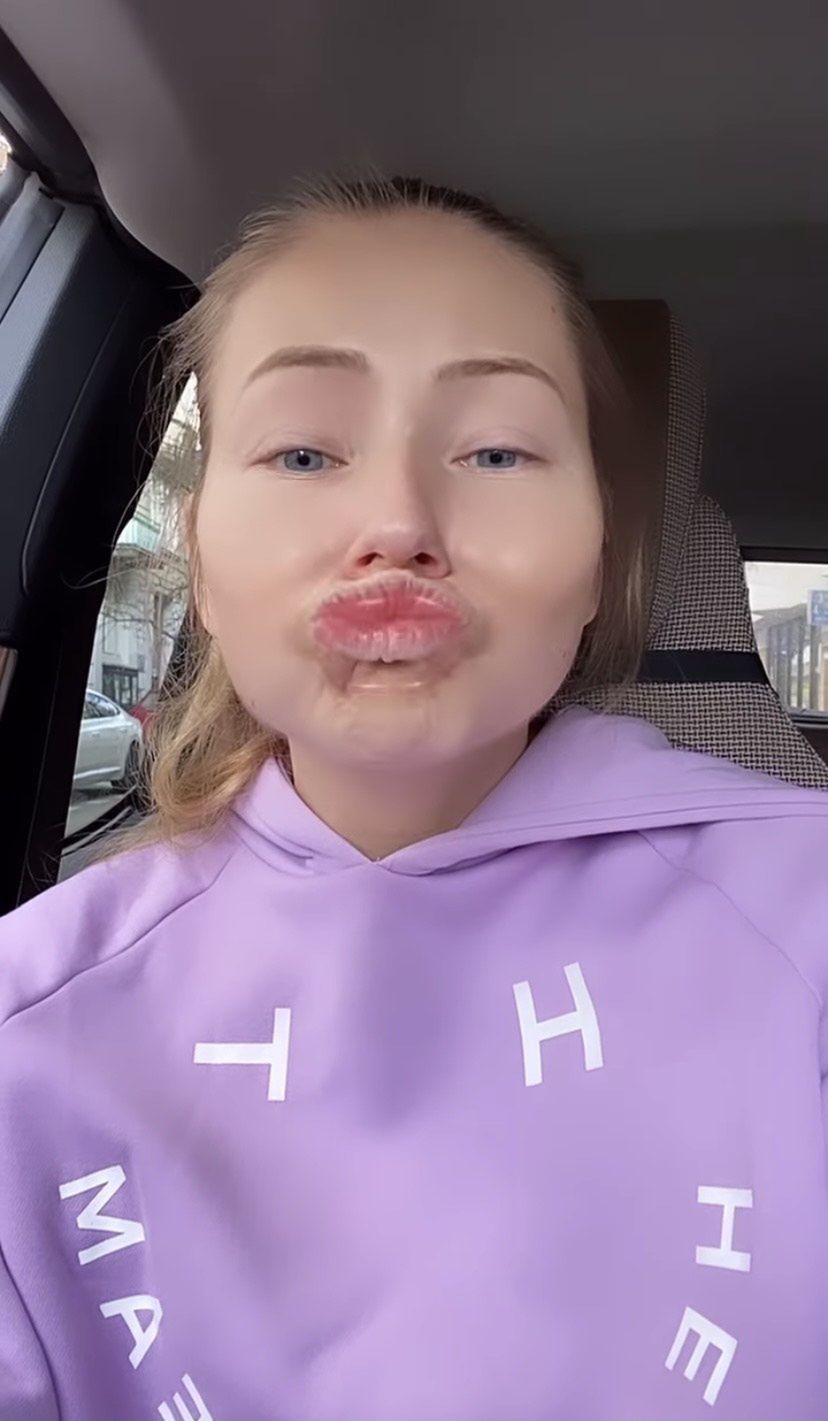 Agata Rubik pokazała, jak wyglądałaby z wypełniaczami w twarzy