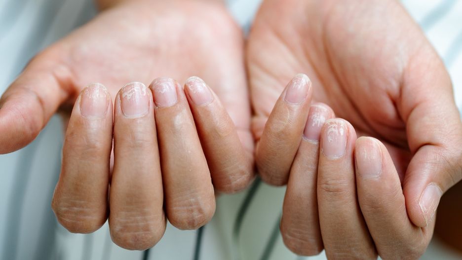 Jeżeli twoje paznokcie potrzebują natychmiastowej pomocy, istnieje prosty sposób