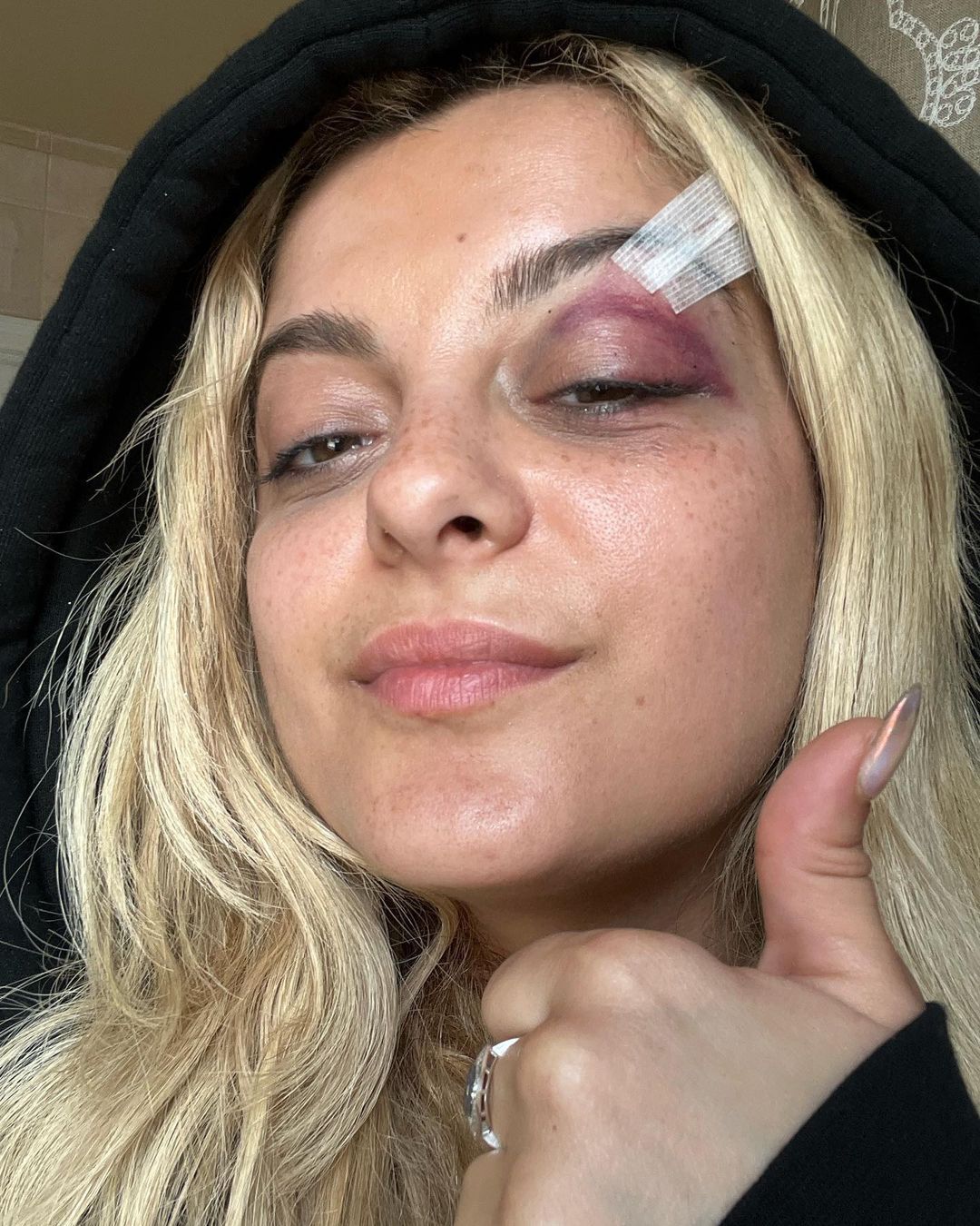 Bebe Rexha po interwencji lekarzy