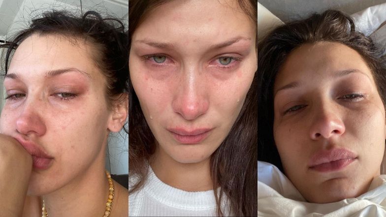 Zapłakana Bella Hadid otwiera się w temacie zdrowia psychicznego: "TAK WYGLĄDA KAŻDY MÓJ DZIEŃ, każda noc"