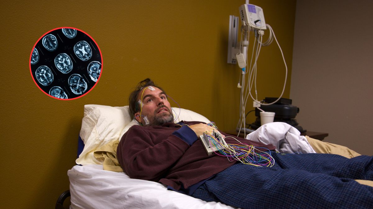 Zaburzenia snu fazy REM są najwcześniejszym objawem tego rodzaju demencji