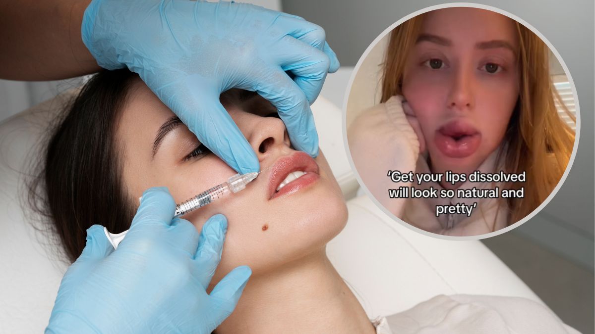 Rozpuszczanie ust ma skutki uboczne.