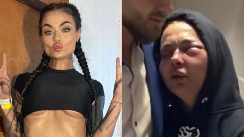 Zusje pokazuje, jak wygląda jej twarz 10 dni po walce 