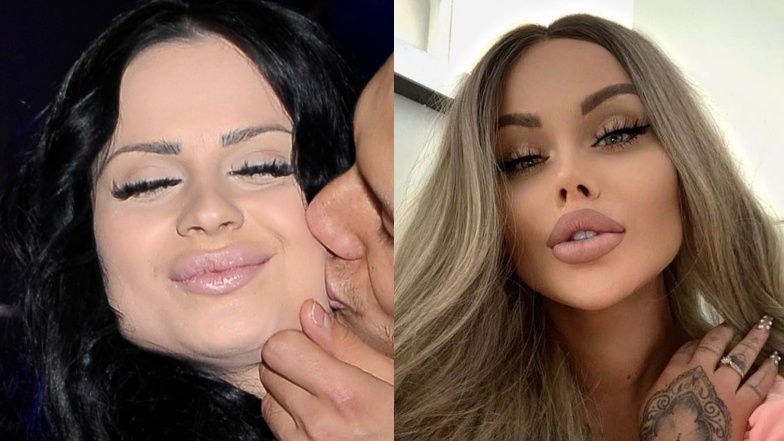 Gwiazdy, które zrobiły sobie nos