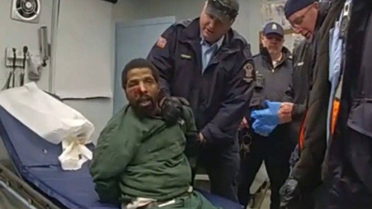 Zakrwawiona twarz Roberta Brooksa.