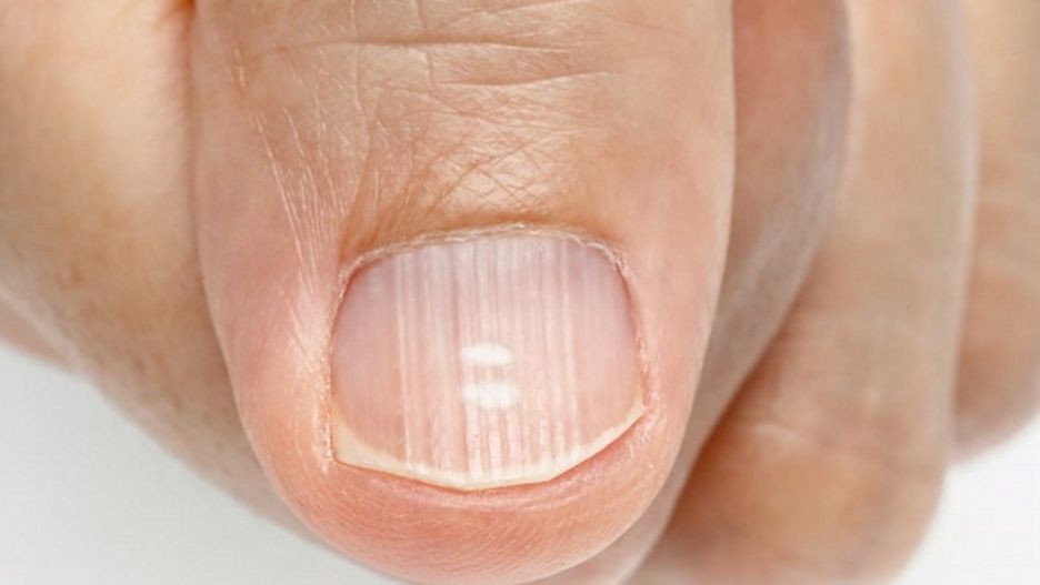 Paznokcie mogą wiele powiedzieć o stanie zdrowia