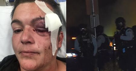 Fotografka straciła wzrok w zamieszkach. Złożyła pozew przeciw policji