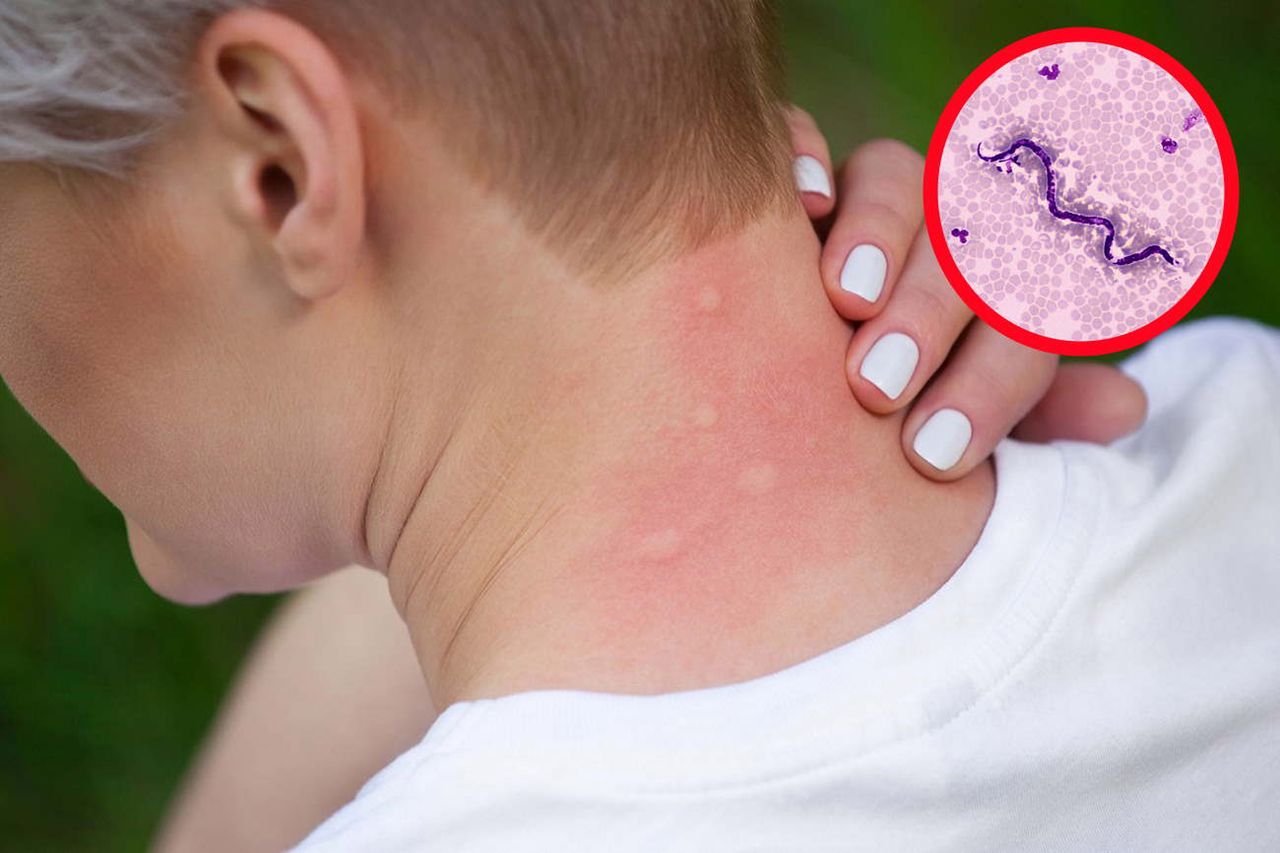 Lekarze ostrzegają. Komary występujące w Polsce mogą przenosić te choroby