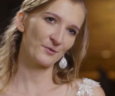 Iga ze "Ślubu od pierwszego wejrzenia" przeszła operację plastyczną. Zdradziła szczegóły