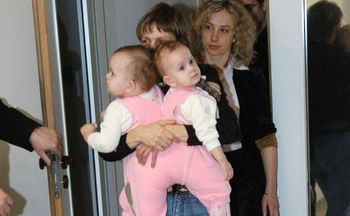 Bliźniaczki syjamskie rozdzielono 21 lat temu. Tak wyglądają dziś