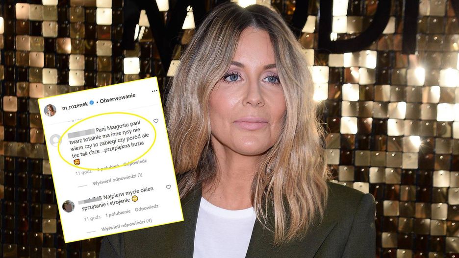 Małgorzata Rozenek i jej "totalnie inne rysy" twarzy