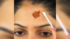 Maseczka na wypryski