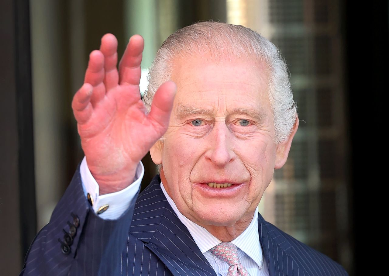 Karol III ma opuchnięte i zaczerwienione dłonie?
