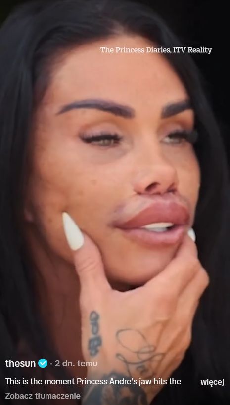 Tak córka Katie Price zareagowała na jej nowe usta