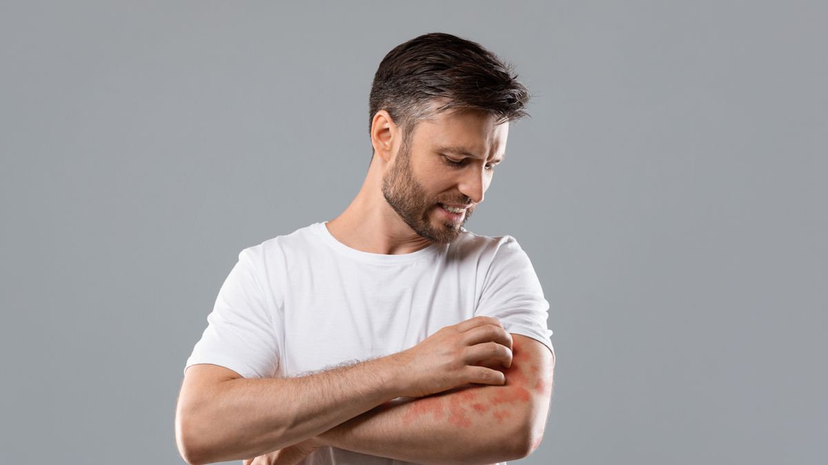 Erytrodermia to uogólnione zapalenie skóry.