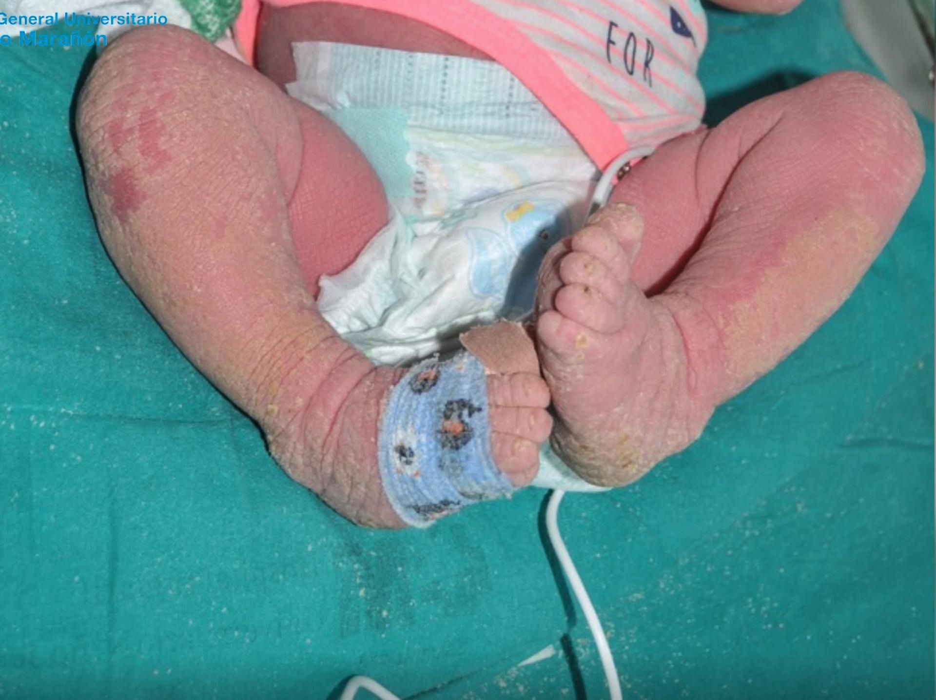 Dziewczynka w szpitalu podczas badania