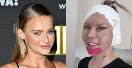 Karolina Pisarek gorzko o liftingu Julii Von Stein. "Jest po prostu za młoda na takie coś"