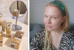 Terapia śluzem ślimaka naprawdę odejmuje lat? Sprawdziłam na własnej skórze