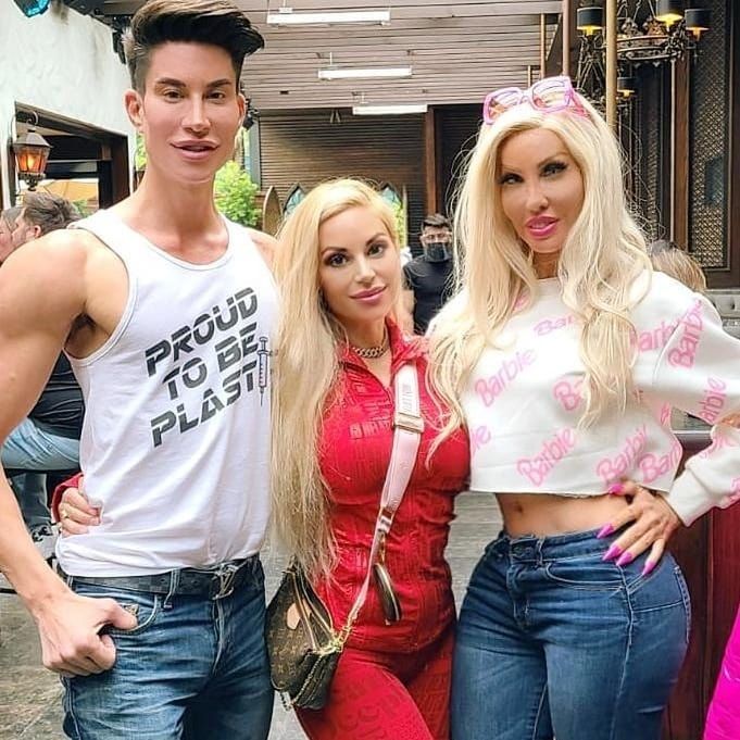 Oto Marcela Iglesias, samozwańcza "Królowa Hollywood" i "żywa Barbie" z chętką na wygląd Pameli 