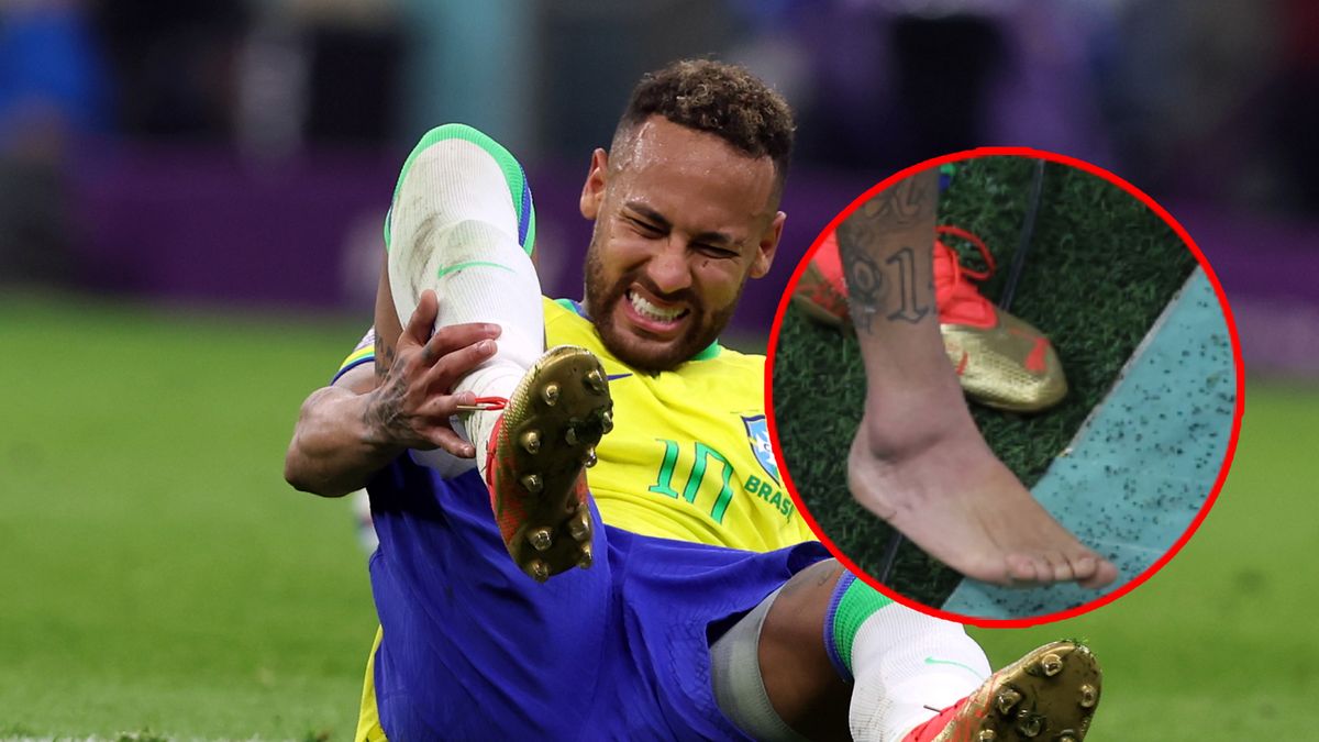 Neymar i jego kontuzjowana kostka