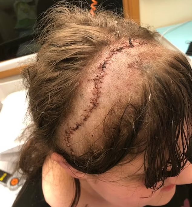 Bonnie po operacji usunięcia zainfekowanej kości