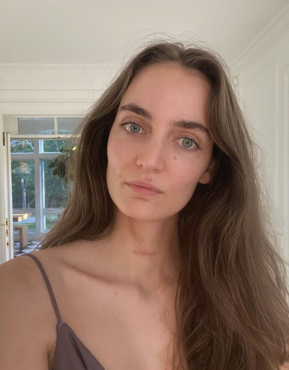 Zuzanna Bijoch walczyła z nowotworem