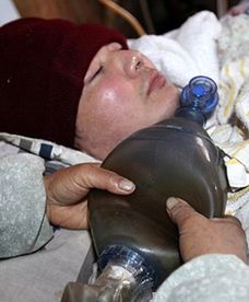 Fu Xuepeng od 7 lat żyje dzięki ręcznemu respiratorowi