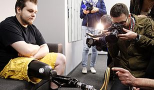 Ta proteza ma być niezniszczalna