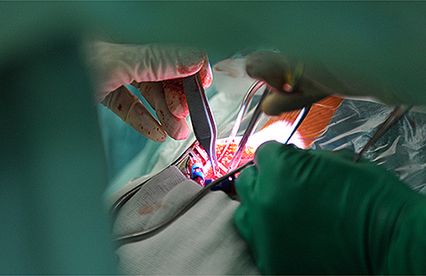 Pionierska operacja na otwartym mózgu w Szczecinie