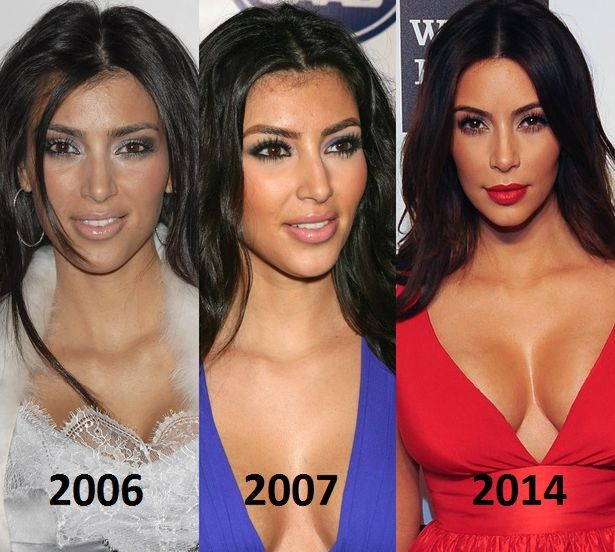 Kim Kardashian: jej twarz wiele przeszła. Jeszcze kilka lat temu wyglądała zupełnie inaczej...
