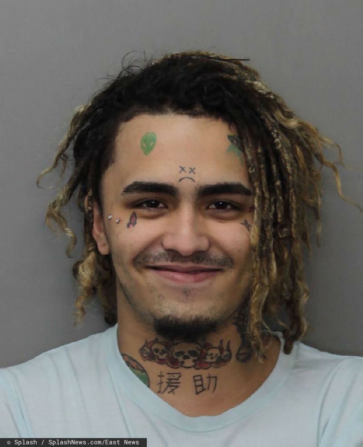 Lil Pump wszczepił sobie w czoło diament