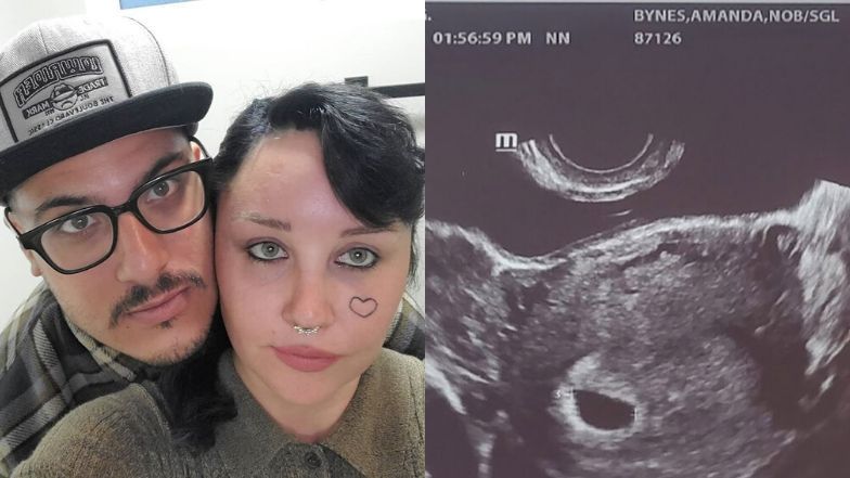 Amanda Bynes jest w ciąży