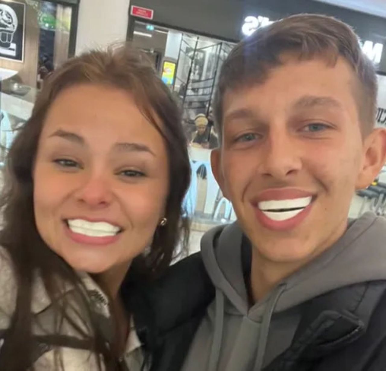 A pair of friends showed "Turkish teeth"