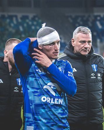 Kobacki ze szwami po meczu z Radomiakiem. Wisła Płock informuje o stanie zdrowia piłkarzy
