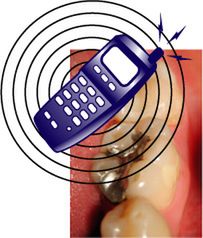 Komórki powodują wydzielanie się rtęci z plomb w zębach 1