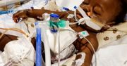 Cud w szpitalu. Dziecko przeżyło niemożliwe