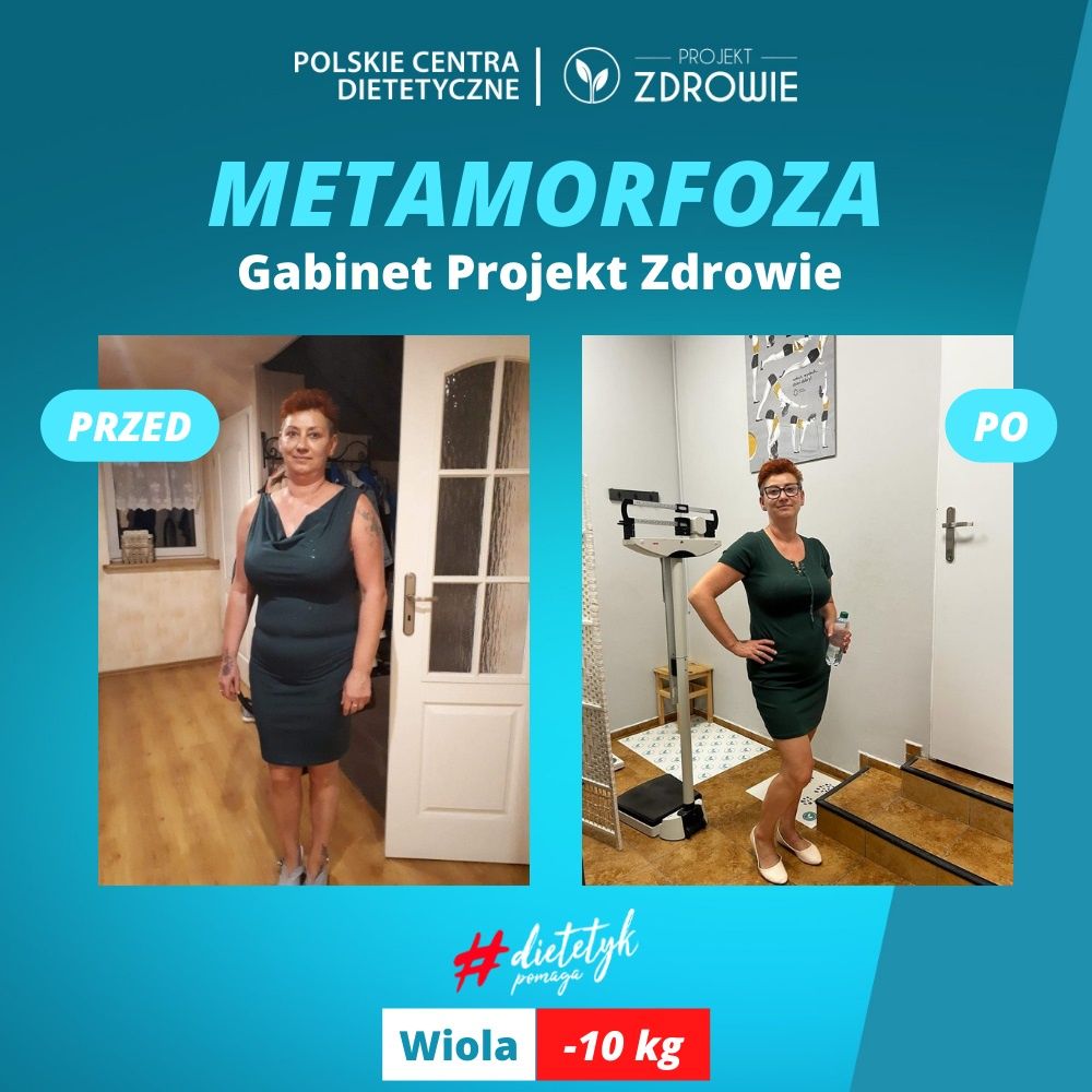Metamorfoza Pani Wioli w Projekt Zdrowie