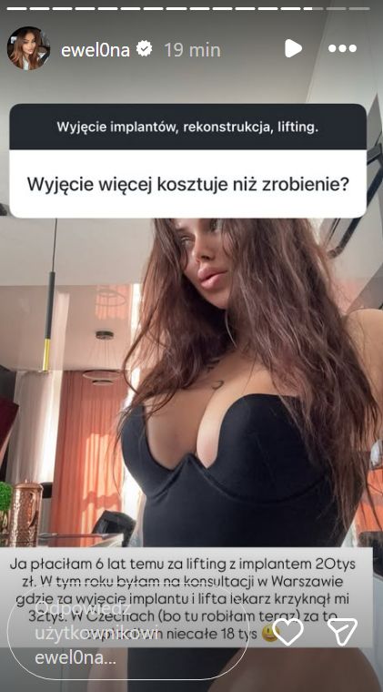 Ewelona o kosztach operacji