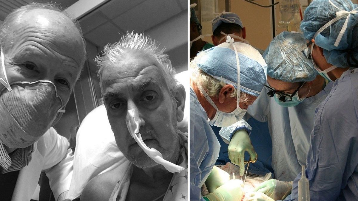 David Bennett nie żyje, jako jedyny na świecie miał wszczepione serce świni