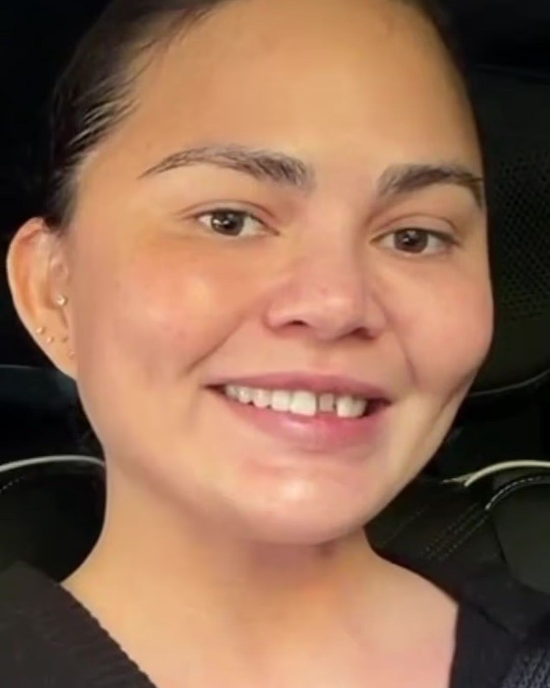 Chrissy Teigen ukruszyła sobie zęba