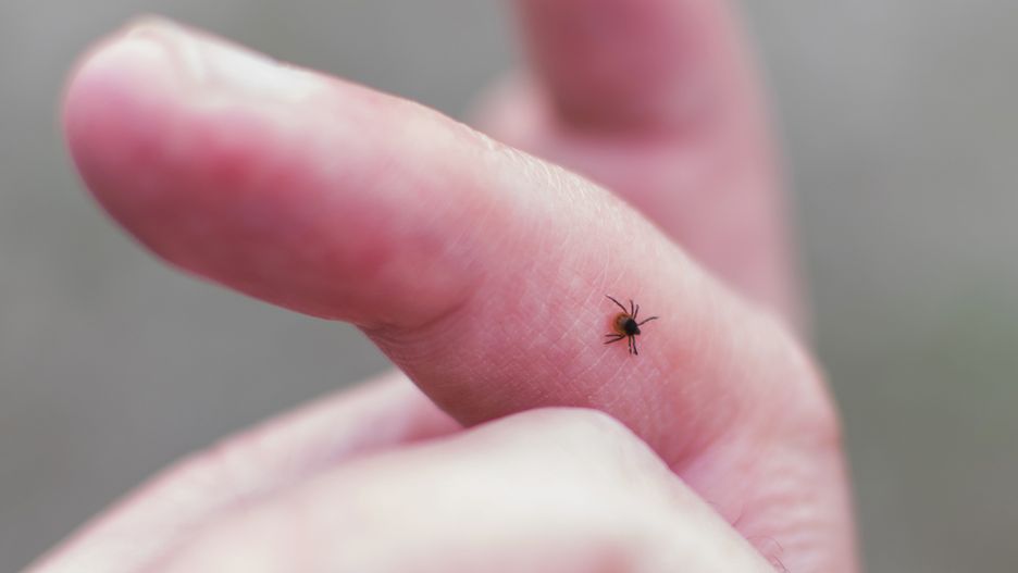 Tick season. Lyme disease - caused by tick bites.
prevention, field, health care, mites, borreliosis, lyme disease, lyme park, lime, skin care, protection, grass, park, human hand, people, danger, insecticide, insect tick, bloodsucker, bite, infected tick, tick, insect, summer, forest, bug, outdoors, outdoor, nature, hand, skin, person, animal, encephalitis, parasite, close-up, blood, disease, macro, sucking, human, dangerous, infection, injection, environment, hiking, health, green, pain, finger, man, prevention, field, health care, mites, borreliosis, lyme disease, lyme park, lime, skin care, protection, grass, park, human hand, people, danger, insecticide, insect tick, bloodsucker, bite, infected tick, tick, insect, summer, forest, bug, outdoors, outdoor, nature, hand, skin, person, animal, encephalitis, parasite, close-up, blood, disease, macro, sucking, human, dangerous, infection, injection, environment, hiking, health, green, pain, finger
