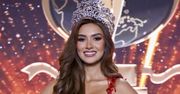 Została Miss Supranational. Kilka lat temu wyglądała inaczej